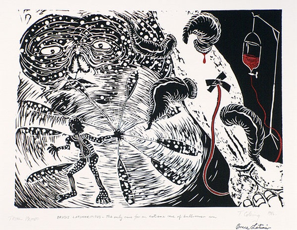 Artist: b'COLEING, Tony' | Title: b'Brusis Latimerititus - the only cure for an extreme case of a bullroarer arm.' | Date: 1986-87 | Technique: b'linocut, printed in black ink, from one block; hand-coloured' | Copyright: b'\xc2\xa9 Bruce Latimer' Artist: b'COLEING, Tony' | Title: b'Brusis Latimerititus - the only cure for an extreme case of a bullroarer arm.' | Date: 1986-87 | Technique: b'linocut, printed in black ink, from one block; hand-coloured' | Copyright: b'\xc2\xa9 Bruce Latimer'
