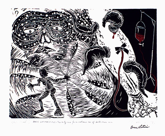 Artist: b'COLEING, Tony' | Title: b'Brusis Latimerititus - the only cure for an extreme case of a bullroarer arm.' | Date: 1986-87 | Technique: b'linocut, printed in black ink, from one block; hand-coloured' | Copyright: b'\xc2\xa9 Bruce Latimer' Artist: b'COLEING, Tony' | Title: b'Brusis Latimerititus - the only cure for an extreme case of a bullroarer arm.' | Date: 1986-87 | Technique: b'linocut, printed in black ink, from one block; hand-coloured' | Copyright: b'\xc2\xa9 Bruce Latimer'